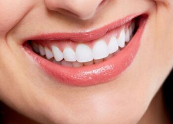 Things to Consider When Choosing a Cosmetic Dentist