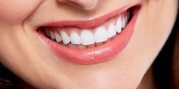 Things to Consider When Choosing a Cosmetic Dentist