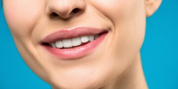 “Unlocking the Brilliance of PAP Teeth Whitening Strips: A Comprehensive Guide to Brighter Smiles”
