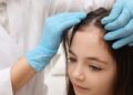Lice